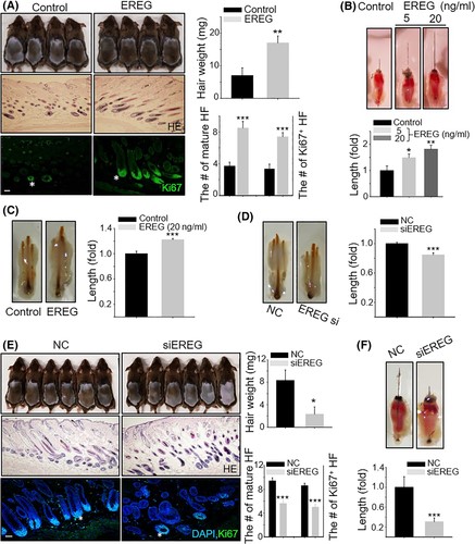 EREG promotes hair growth in vivo and ex vivo. 