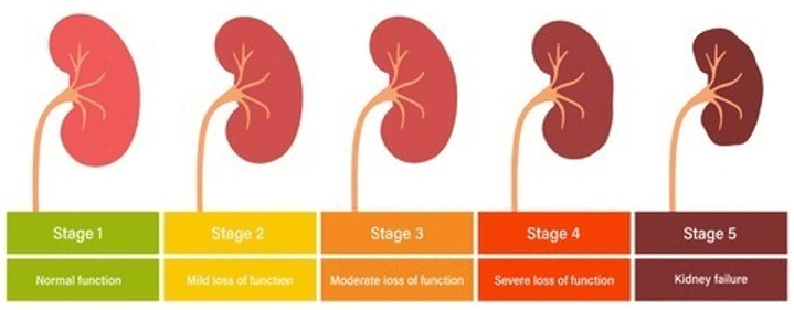 Chronic Kidney Disease