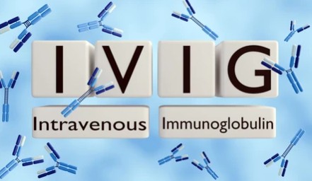 ivig