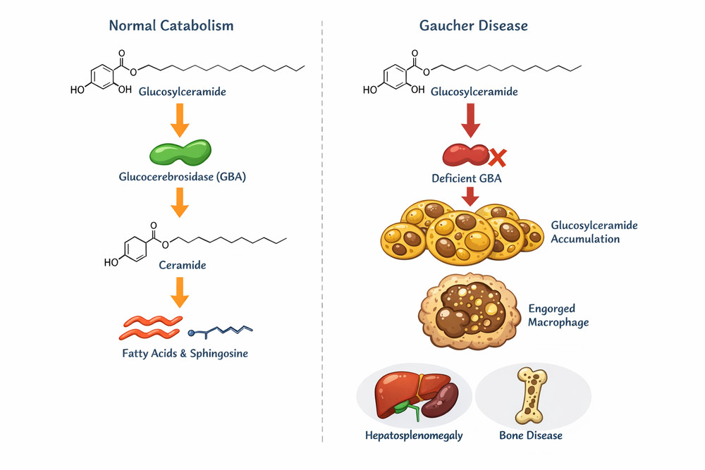 Glucosylceramide Metabolism Pathway